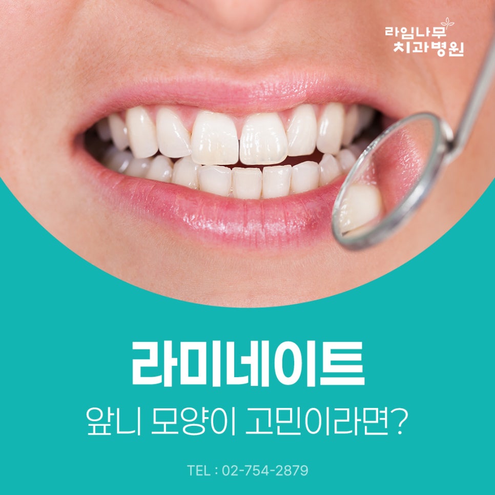 명동 라미네이트 앞니 모양이 고민이라면? 라미네이트로 개선할 수 있는 경우 관련 이미지 2