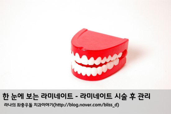한 눈에 보는 라미네이트 - 라미네이트 시술 후 관리 관련 이미지 1