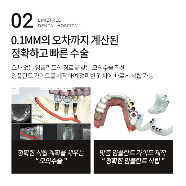 당일임플란트 20년 노하우가 남다르른 곳 관련 이미지 5