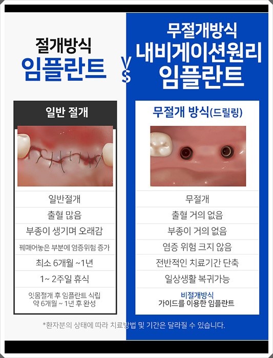 라임나무치과 오스템임플란트 비용이 궁금하셨다고요? 관련 이미지 7