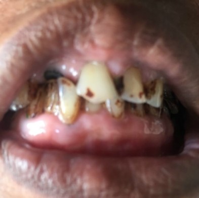 2015 라임나무치과병원 캄보디아 의료봉사 후기를 공개합니다 관련 이미지 7