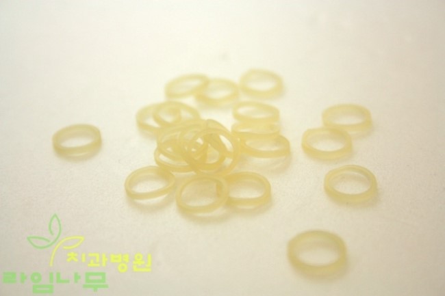 치아교정용 고무줄 사용하는 이유는? 관련 이미지 1