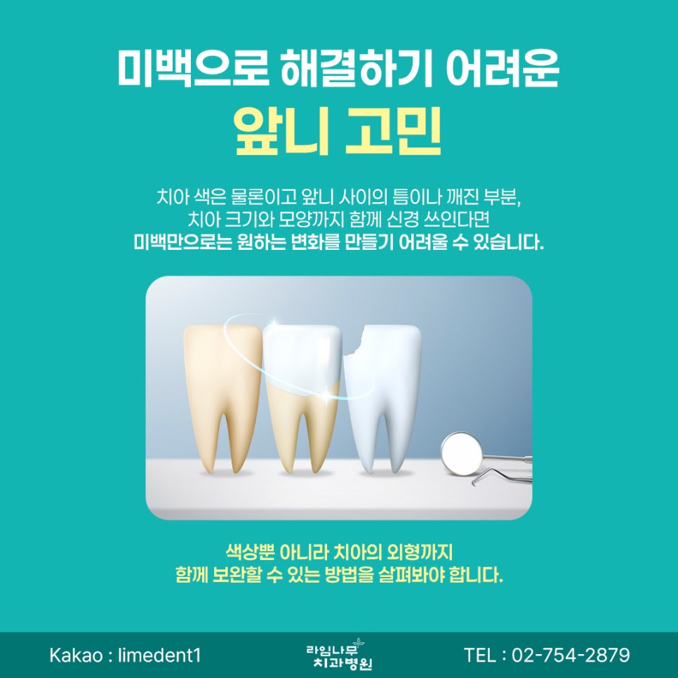 Myeongdong Laminate Veneers: How Do Laminate Veneers and Teeth Whitening Differ for Front-Tooth Concerns? image 5