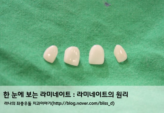 한 눈에 보는 라미네이트 : 라미네이트의 원리 관련 이미지 1