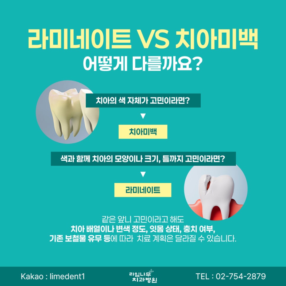 Myeongdong Laminate Veneers: How Do Laminate Veneers and Teeth Whitening Differ for Front-Tooth Concerns? image 7