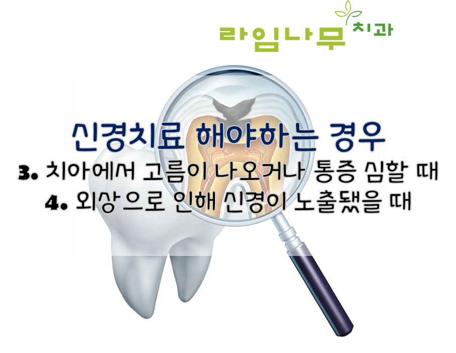 신경치료 해야되는 경우? 명동역치과와 증상 알아봐요 관련 이미지 4