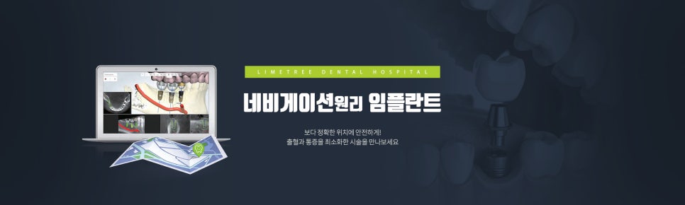 [베이비타임즈] 잇몸뼈 없어 포기한 임플란트...다양한 치료 방법 등장 관련 이미지 3