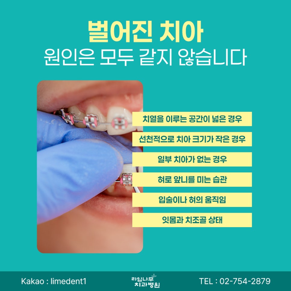 명동 치아교정 벌어진 치아, 치아교정 전 어떤 검사를 받을까요? 관련 이미지 3