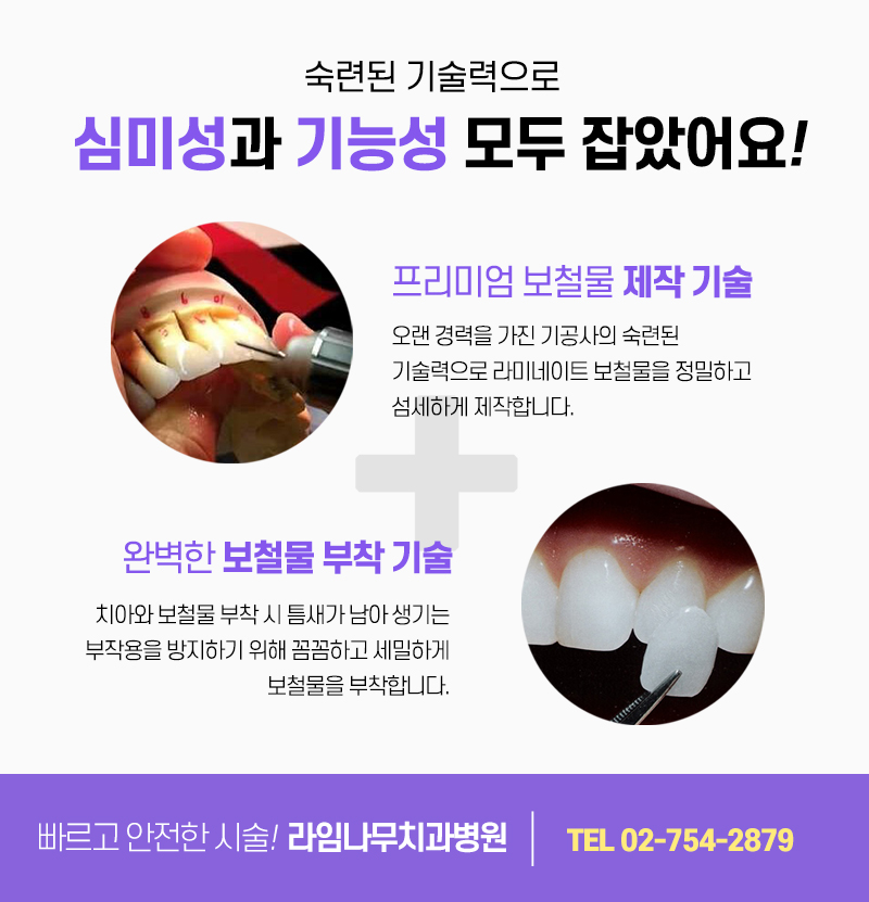 Laminated Veneer Treatment: Careful Decision-Making Is Important image 4