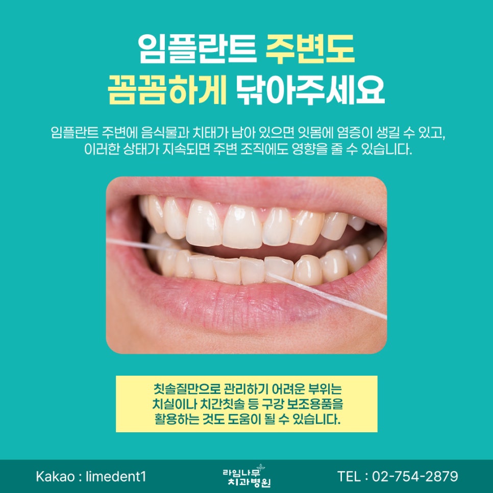 명동 임플란트 임플란트 수명, 오래 사용하려면 어떤 관리가 필요할까요? 관련 이미지 4