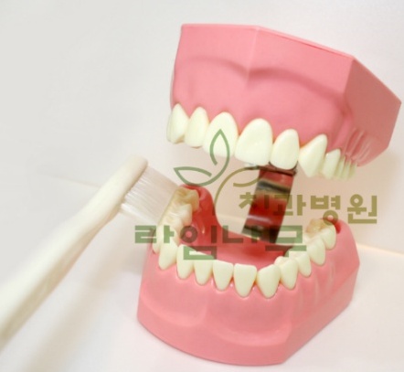입냄새가 나는 이유가 궁금해요 관련 이미지 2