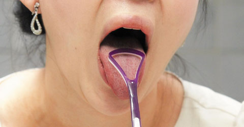 [명동치과]입냄새 진단법, 어떤 방법이 있는지 알아볼까요 관련 이미지 4