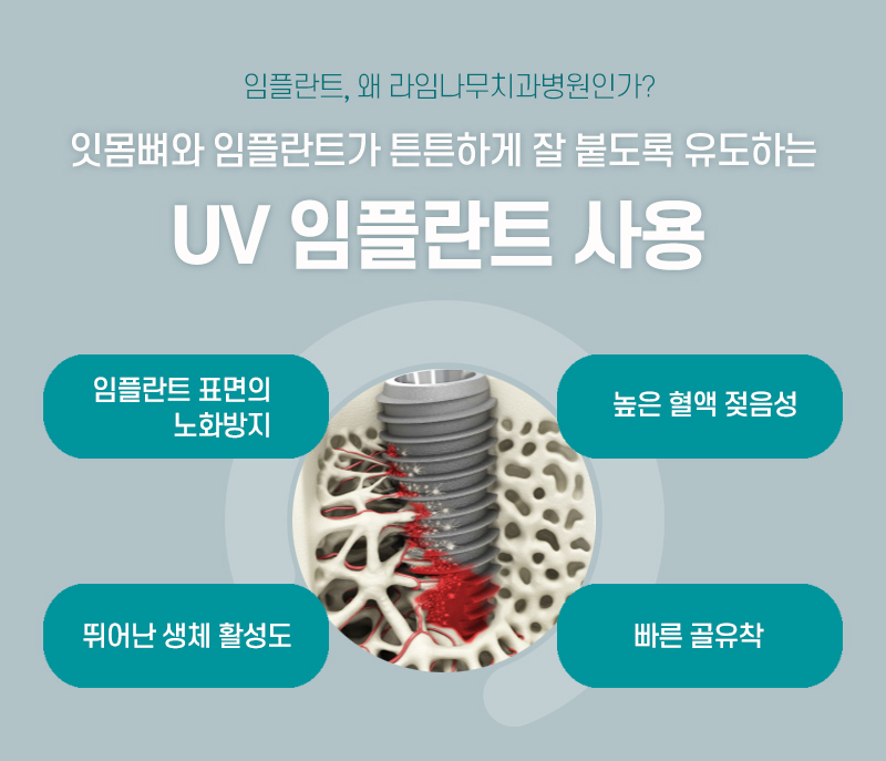Solve Concerns About Missing Teeth with Dental Implants image 5