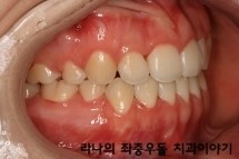 학생교정시 고려할 점은 무엇일까? 관련 이미지 7