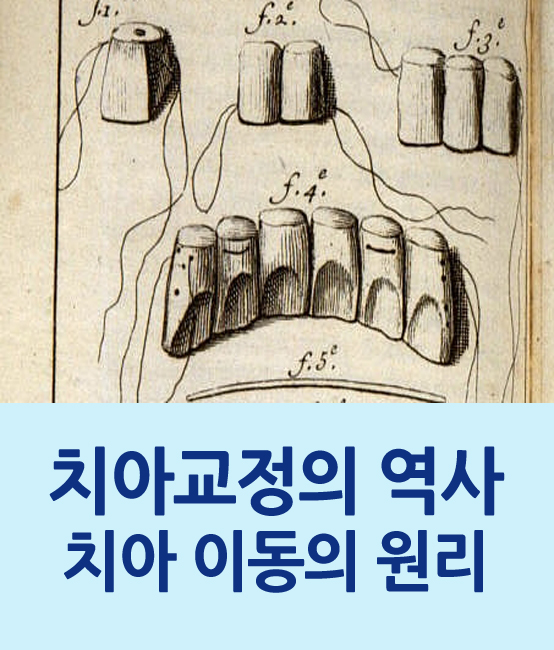 한 눈에 보는 치아교정 이야기 - 치아교정의 역사 관련 이미지 1