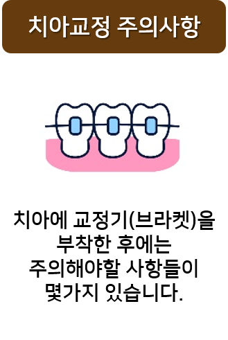 치아교정 음식 딱딱한 것 먹으면 안되는 이유? 명동치과 라임나무 관련 이미지 2