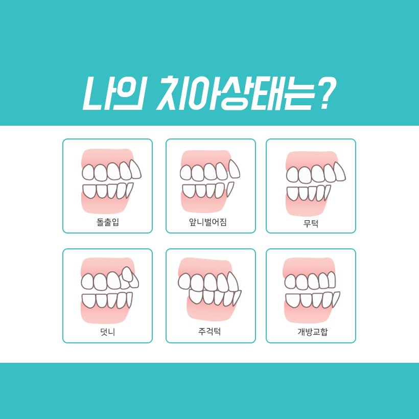 명동치과 라임나무치과에서 치아교정 시작해보세요! 관련 이미지 3