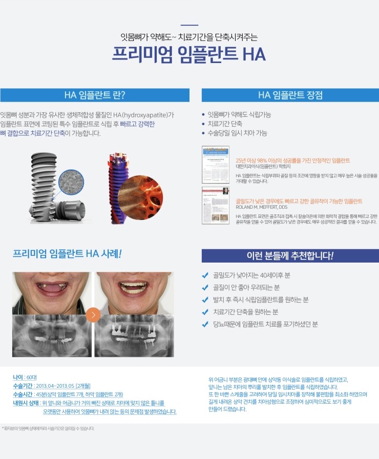 라임나무치과의 임플란트 솔루션을 소개합니다. 관련 이미지 3