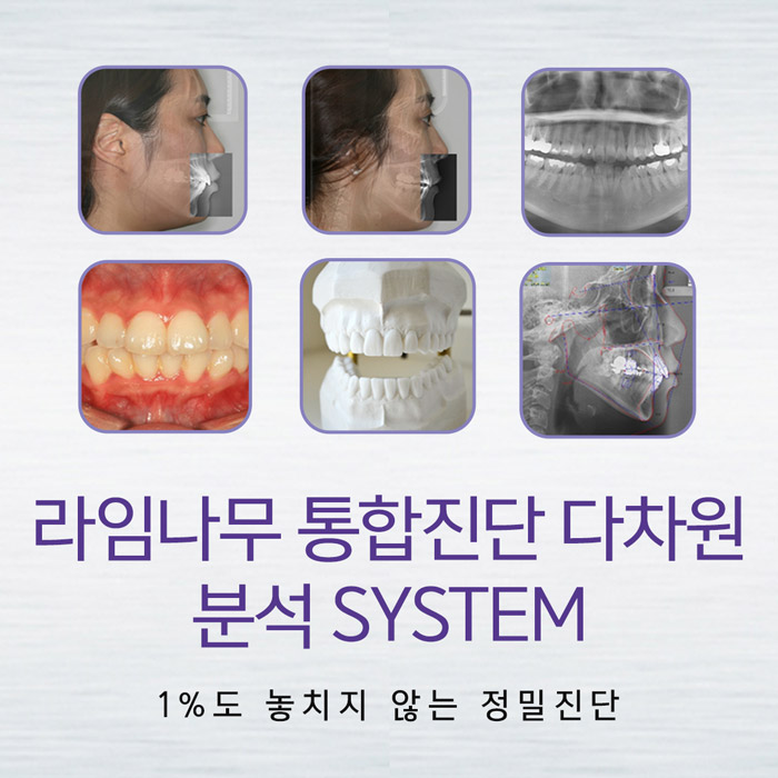 만족스러운 치아교정을 위한 사전 체크포인트 관련 이미지 3