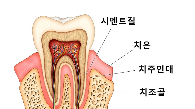 [명동치과 라임나무]치아교정, 원리가 무엇일까요 관련 이미지 2