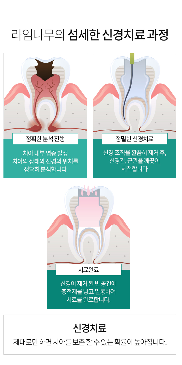 명동치과, 지르코니아 vs 금 ? 관련 이미지 5