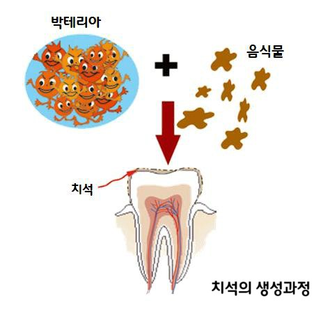 치주질환 예방 양치질만으로 가능할까? 관련 이미지 2