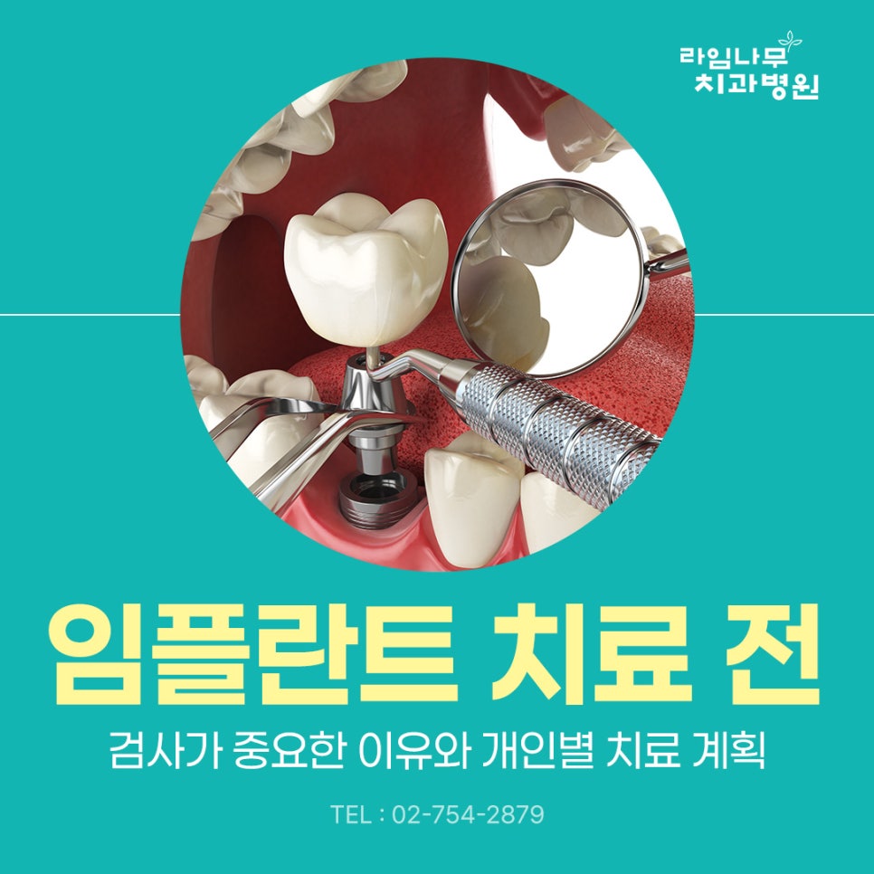 명동 임플란트 치료 전 검사가 중요한 이유와 개인별 치료 계획 관련 이미지 2