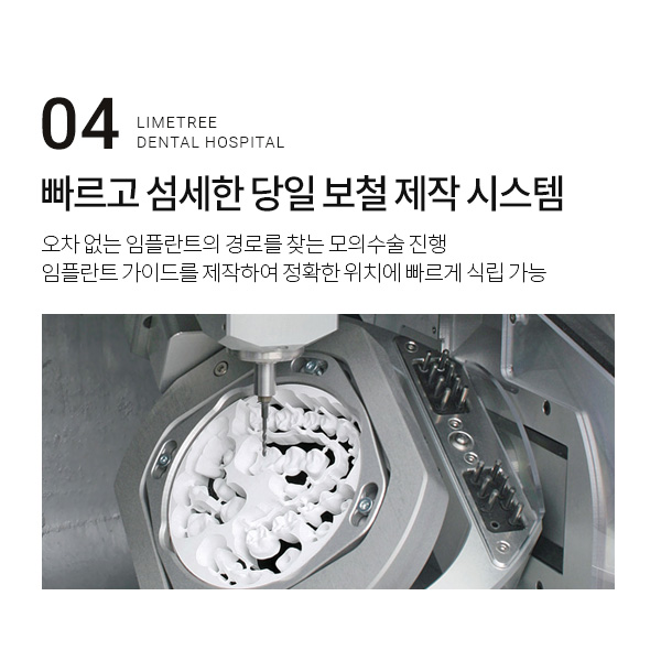 당일임플란트 20년 노하우가 남다르른 곳 관련 이미지 7