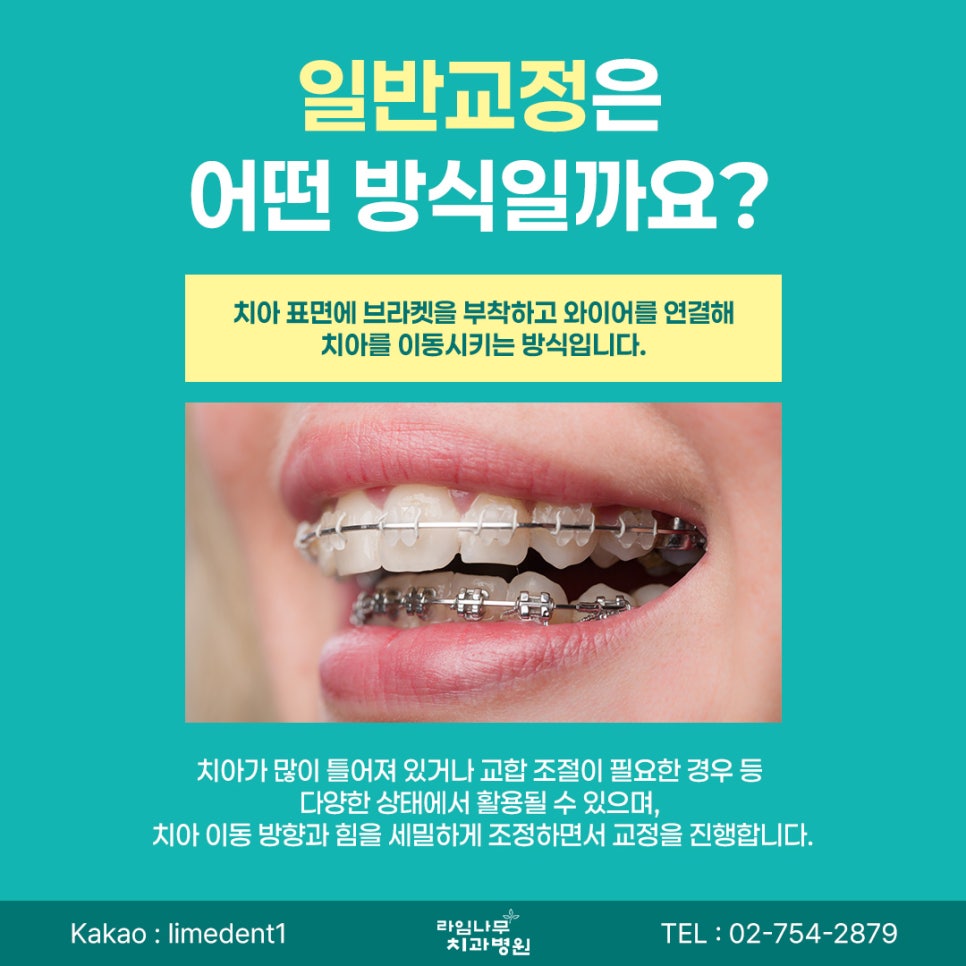 명동 치아교정 투명교정과 일반교정, 어떤 차이가 있을까요? 관련 이미지 4