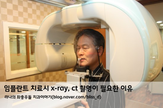 임플란트 치료시 x-ray, ct 촬영이 필요한 이유 관련 이미지 1