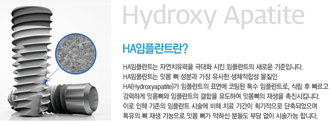 임플란트 고민, 잇몸뼈 재생 촉진하는 HA임플란트로 해결하세요 관련 이미지 3