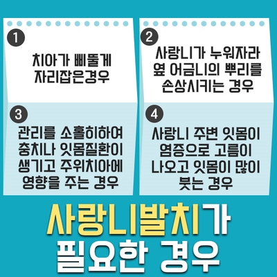 사랑니달인 구강외과 원장님께서 사주신 달달한 꿀라떼 &hearts; 관련 이미지 4