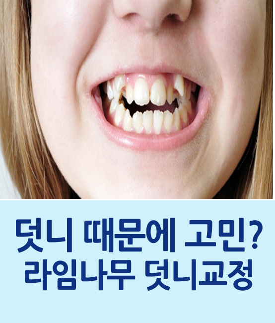 덧니의 정의와 덧니 교정방법 관련 이미지 1