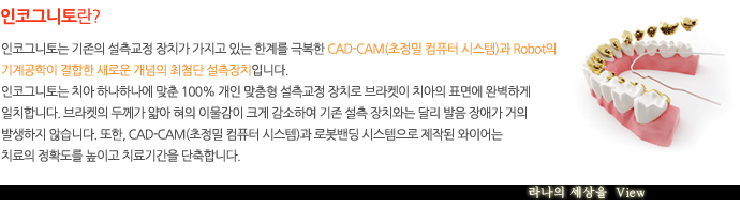 치아교정중에도 밝은 미소로 자신있게 면접보자! 관련 이미지 5