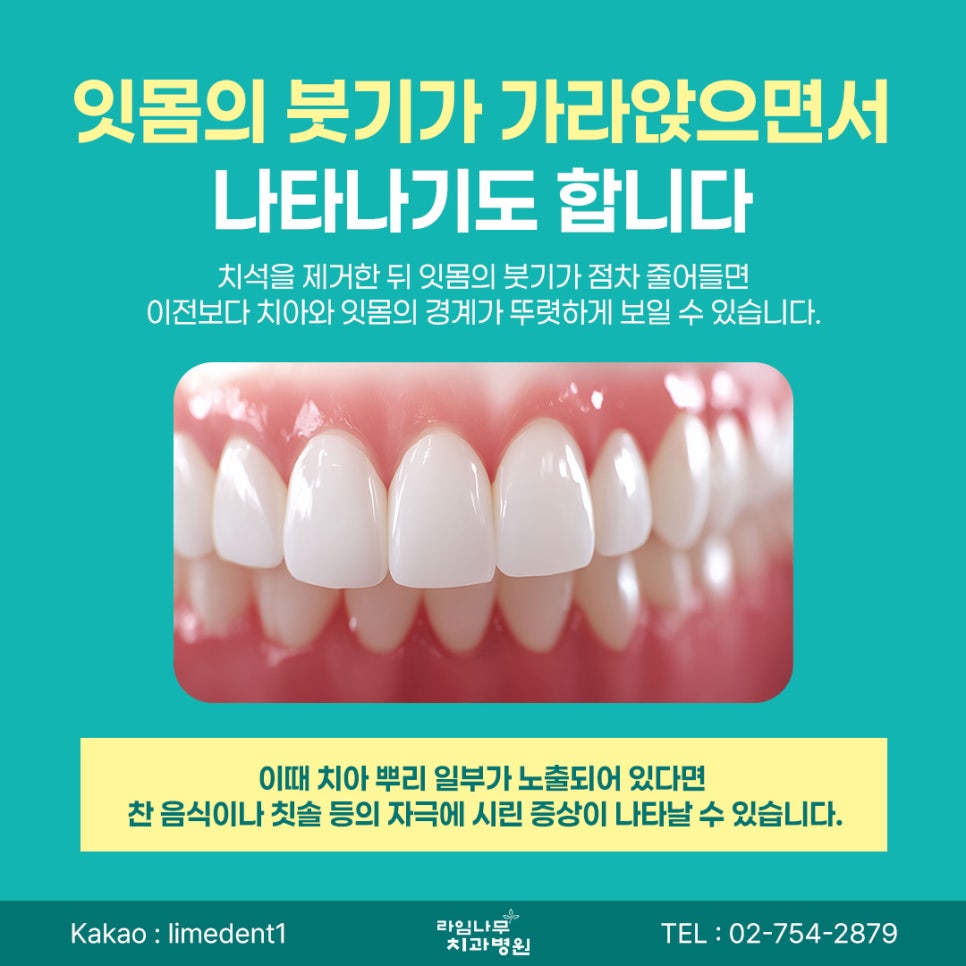 Why Your Teeth May Feel Sensitive After Scaling at a Myeongdong Dental Clinic and How to Care for Them image 4