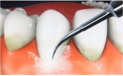 구강보건의 날, 치아 건강 챙기세요 관련 이미지 3