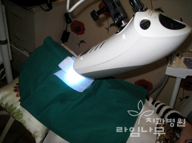 알아야 산다! 치아미백 부작용 어떤게 있을까? 관련 이미지 5