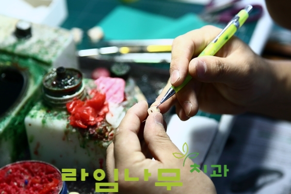 임시치아 빠짐, 빠졌을 때 어떻게? 명동 라임나무치과 관련 이미지 7