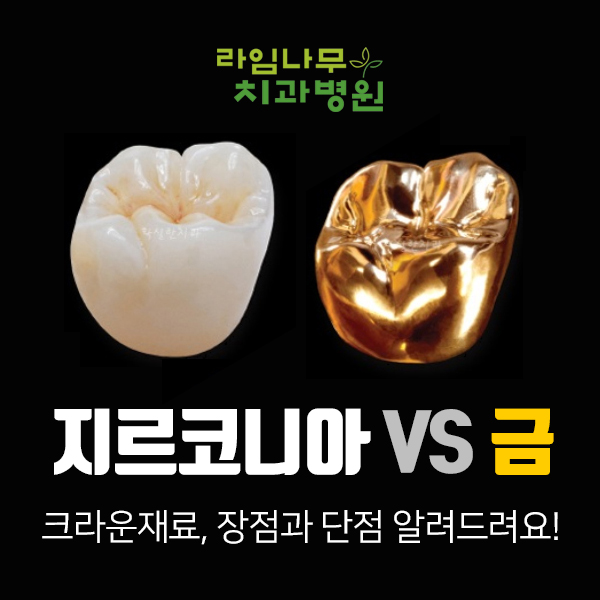 명동치과, 지르코니아 vs 금 ? 관련 이미지 1