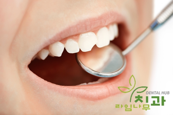 치아를 씌우는 크라운 보철치료! PFM크라운? 지르코니아? 어떤 종류가 있나요? 관련 이미지 7