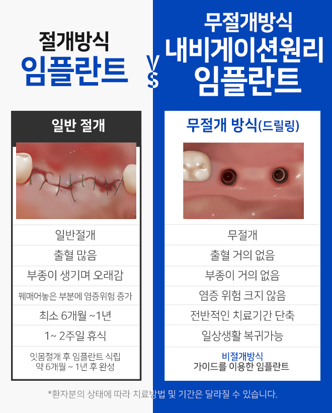 오스템임플란트비용 합리적으로 가능합니다 관련 이미지 7