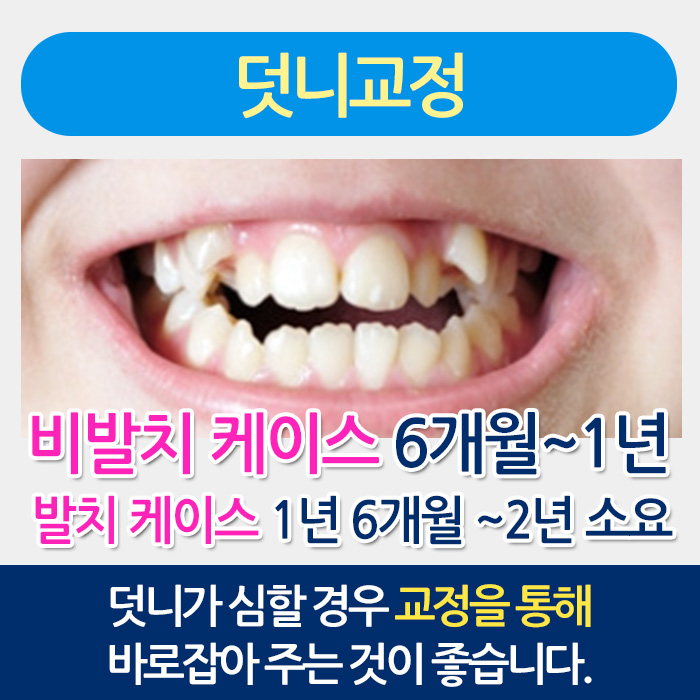 나에게 맞는 치아교정은? 관련 이미지 12