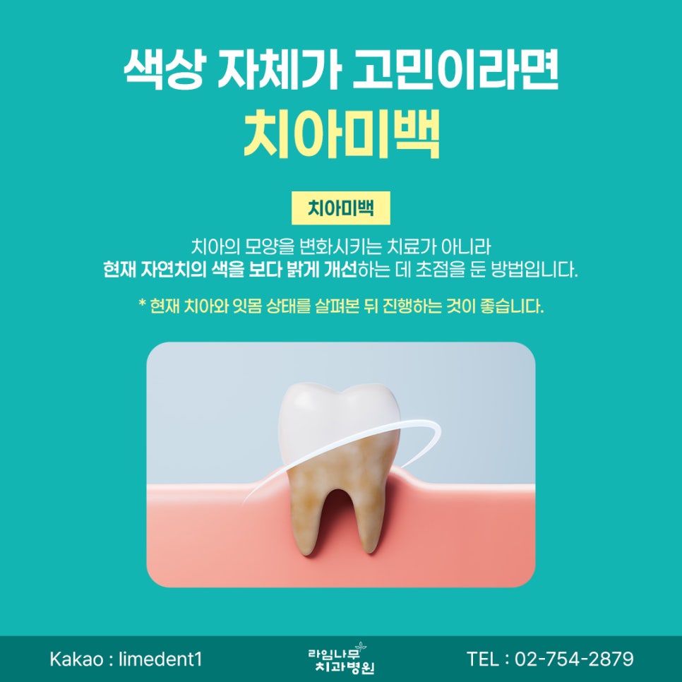 Myeongdong Laminate Veneers: How Do Laminate Veneers and Teeth Whitening Differ for Front-Tooth Concerns? image 4