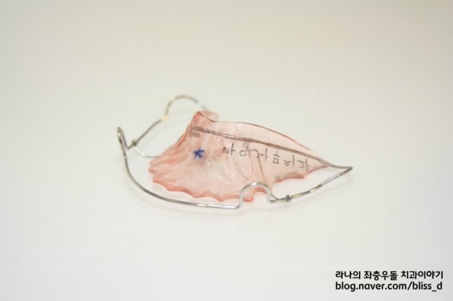 교정할 때 생길 수 있는 부작용과 예방책! 관련 이미지 6