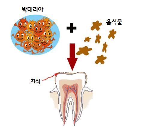 명동치과를 대표하는 라임나무에서 알려드리는 치아상식 VOL1 관련 이미지 2