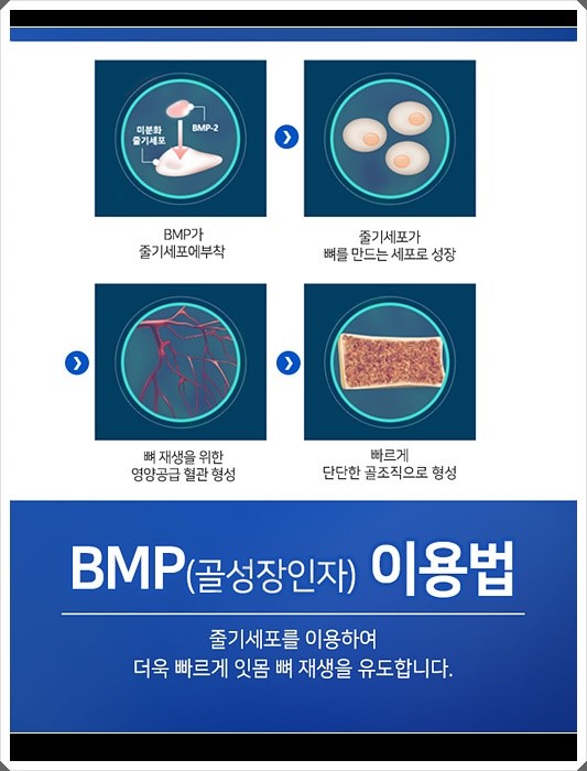 라임나무치과 오스템임플란트 비용이 궁금하셨다고요? 관련 이미지 11