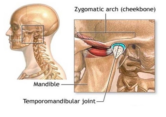 턱관절장애 원인, 어떤 것들이 있으며 치료법은 무엇인지 알아봤어요 관련 이미지 4