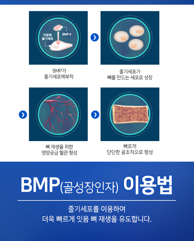 오스템임플란트비용 합리적으로 가능합니다 관련 이미지 10