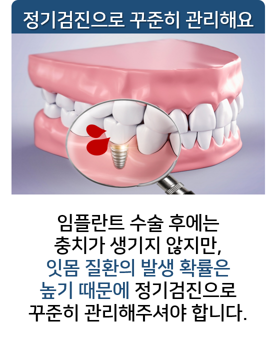 임플란트 부위 피날때, 문제점 알아봐요! 명동치과 라임나무 관련 이미지 4