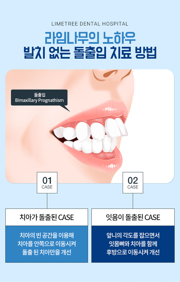 돌출입교정 과유불급! 너무들어가지않게 관련 이미지 1